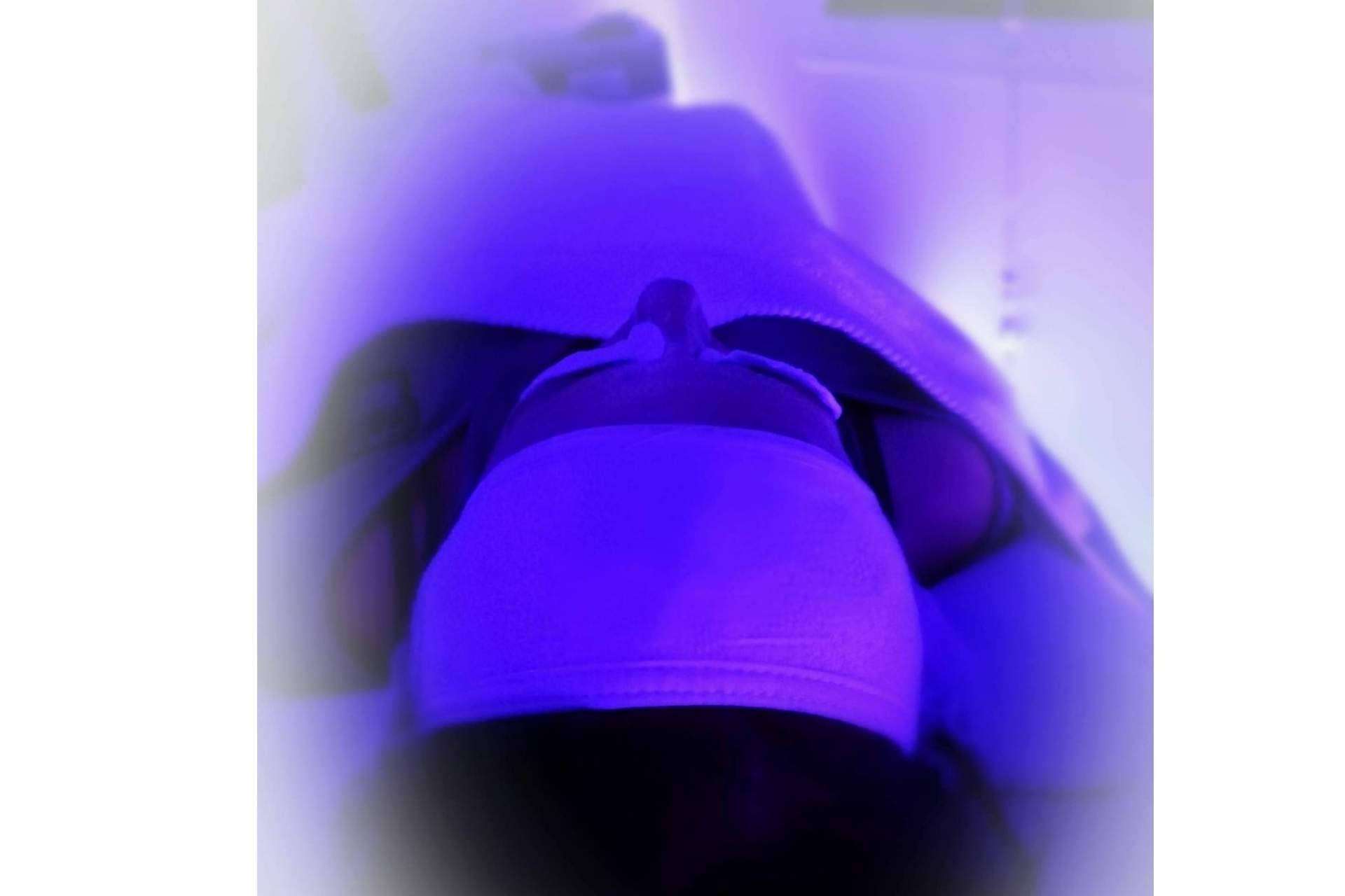 Las ventajas de MiCleo: el tratamiento facial profesional más solicitado en clínicas y centros de estética