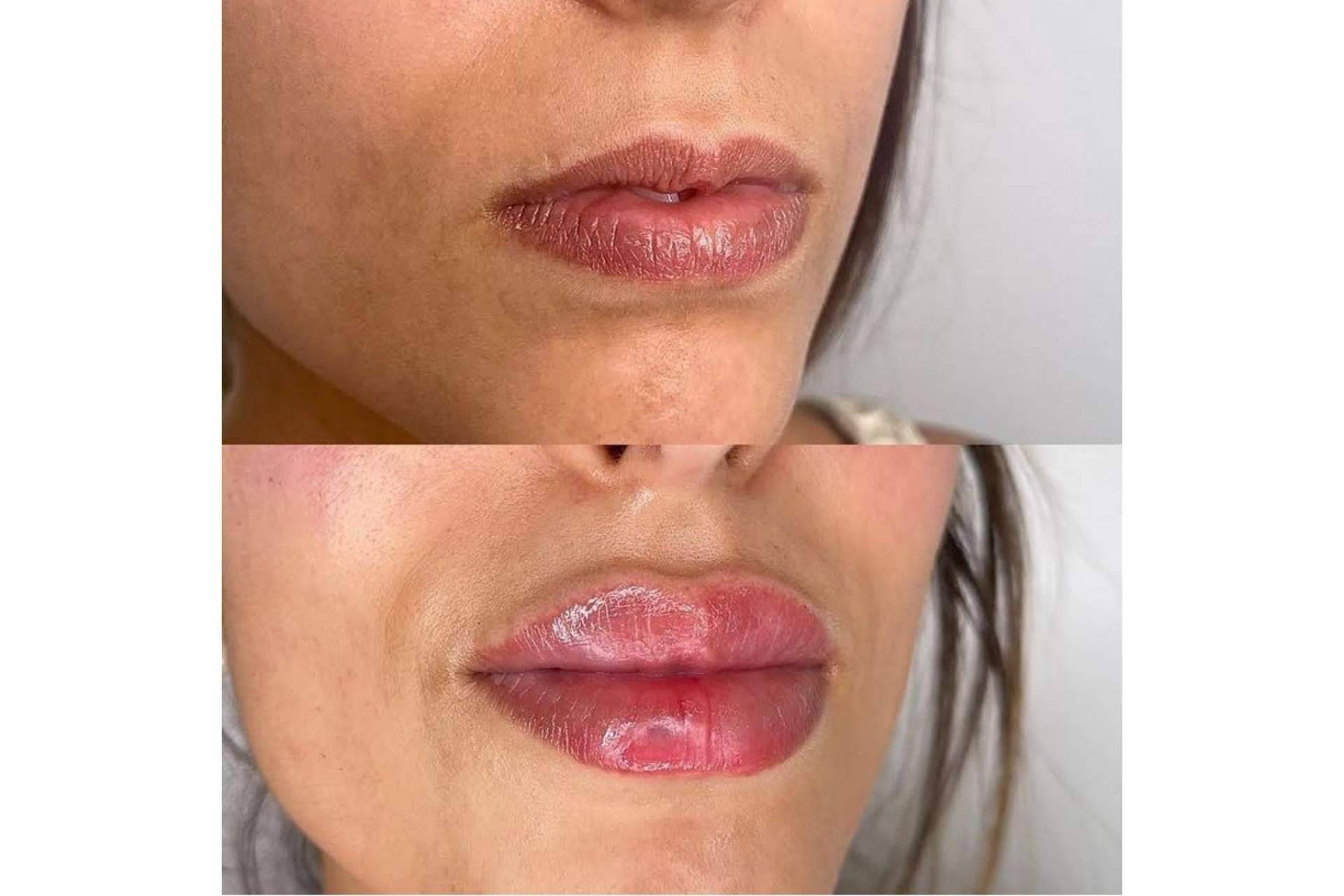 Revitalizar la expresión facial de mujeres y hombres mediante los tratamientos estéticos del doctor Castellar