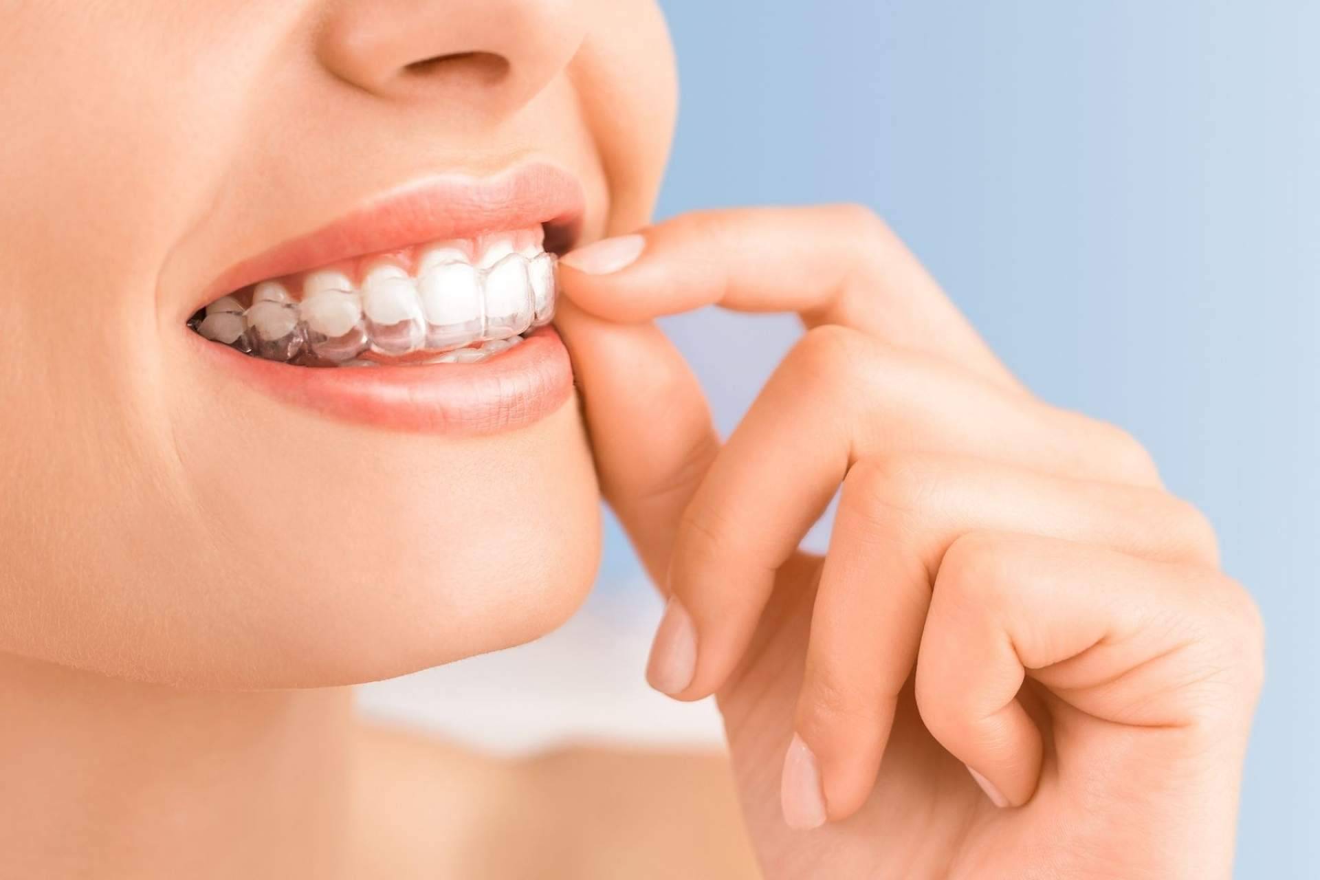 Clínica Viasalud: el efecto rejuvenecedor de la estética dental