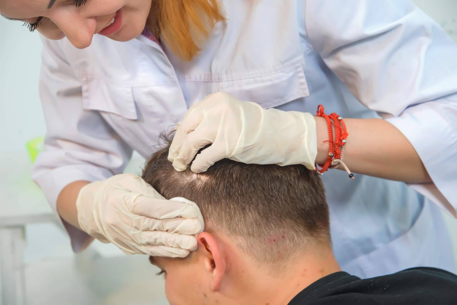 ¿Mesoterapia capilar o láser capilar? Tratamientos de Élite Capilar