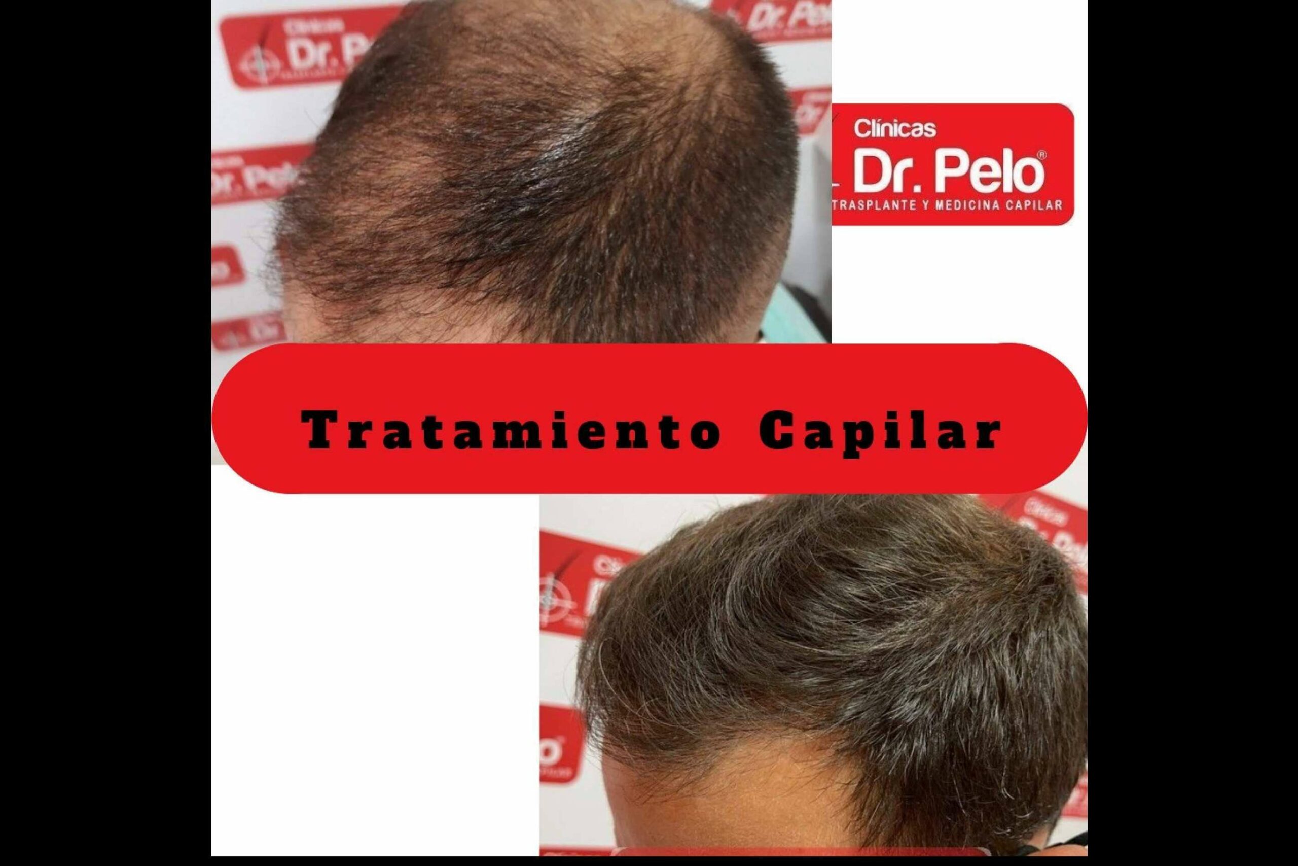 Las Clínicas Dr. Pelo ofrecen todo tipo de tratamientos capilares