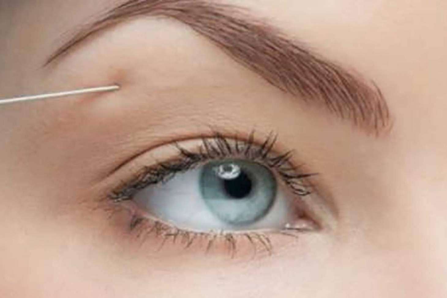 En Castellón, la Clínica de Medicina Estética Sánchez Peral ofrece el diseño de cejas con bótox