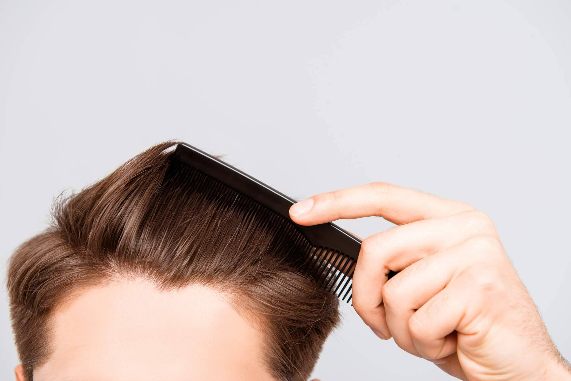 Poner fin a la alopecia con Nanofat, el tratamiento capilar de Clínica Tarrazo
