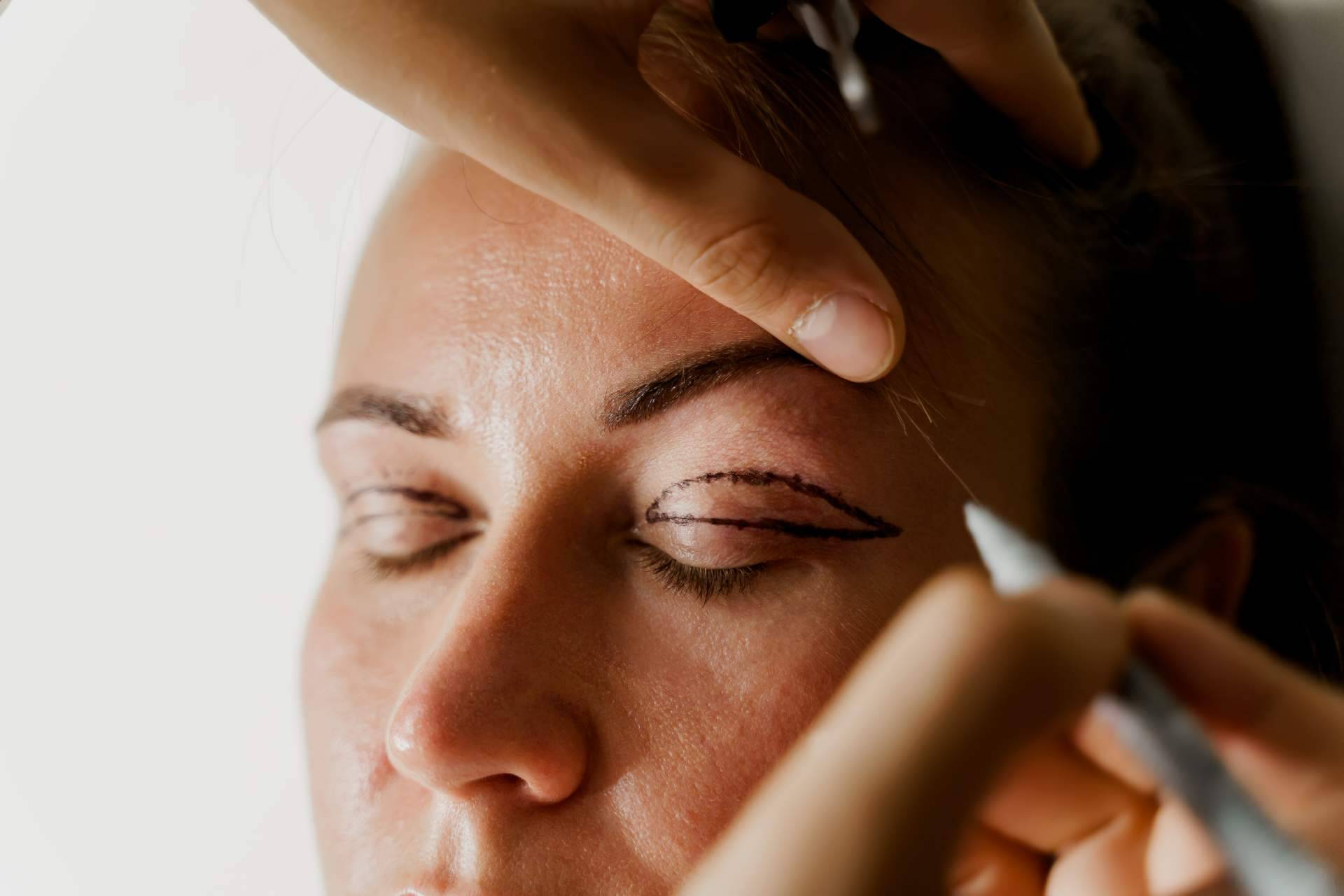 La blefaroplastia no quirúrgica de Alluring Clinic