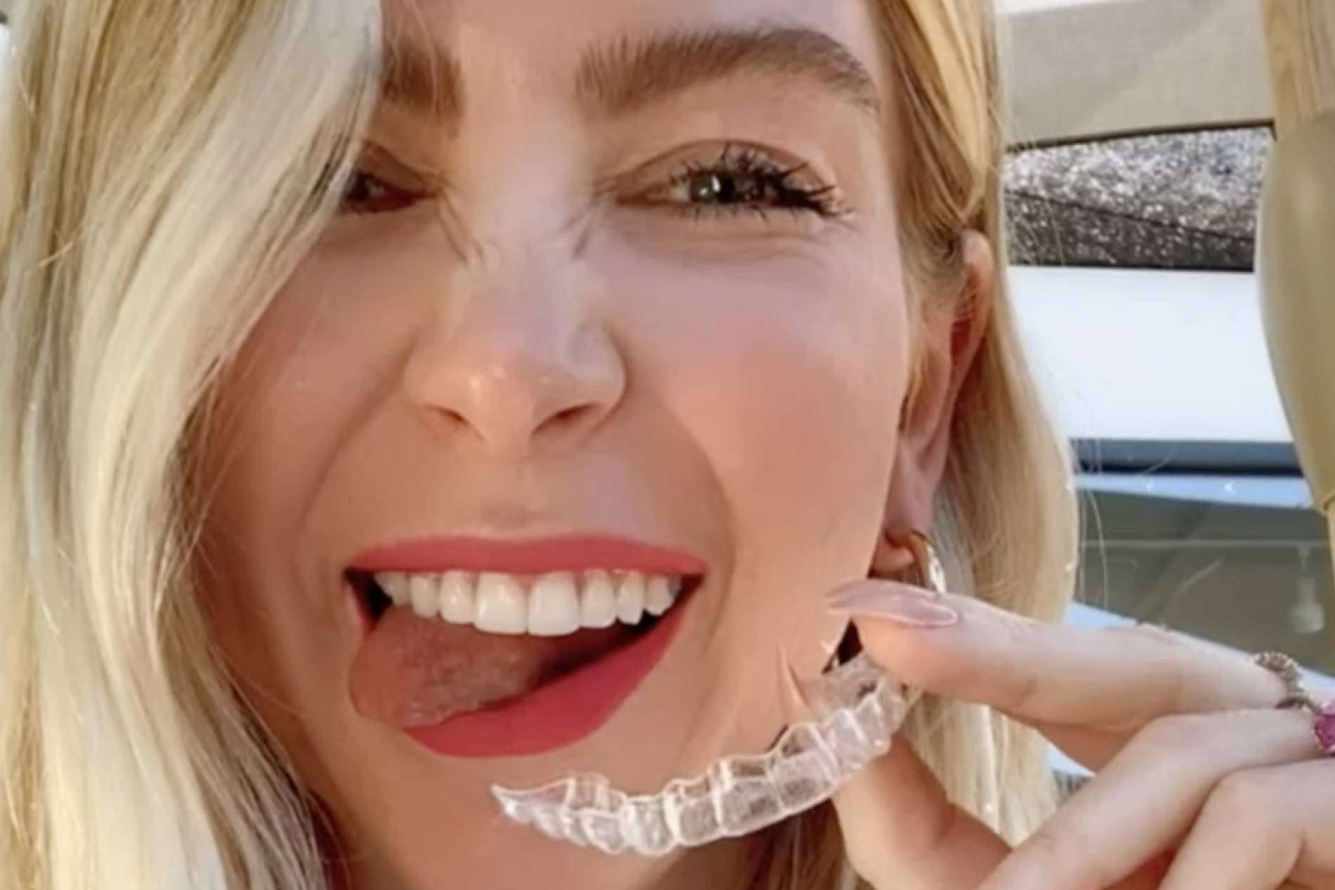 Clínica Dental Ruiz de Gopegui dispone de un precio especial para aquellos pacientes que quieran la ortodoncia invisible Invisalign