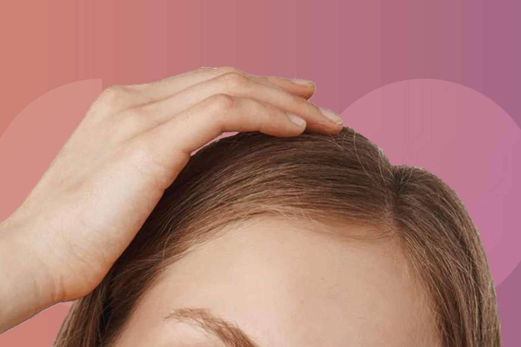 ¿Por qué la caída de cabello estacional viene más fuerte este año?
