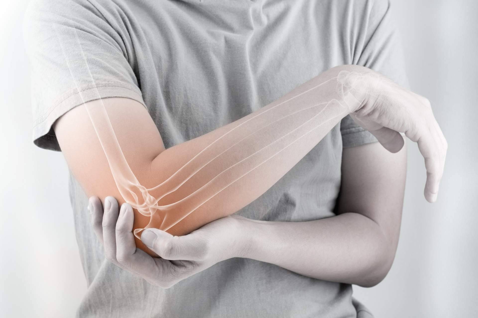 Combatir el dolor articular con la línea de productos de Bibefy