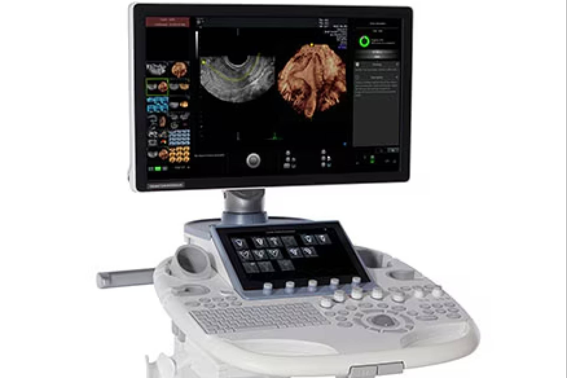 Ecógrafos de alta tecnología y diagnóstico por imagen, la apuesta de SCP Medical en España
